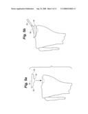 METHOD AND SYSTEM FOR MAMMALIAN JOINT RESURFACING diagram and image