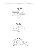 METHOD AND SYSTEM FOR MAMMALIAN JOINT RESURFACING diagram and image