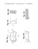 METHOD AND SYSTEM FOR MAMMALIAN JOINT RESURFACING diagram and image