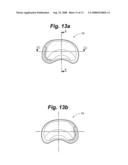 METHOD AND SYSTEM FOR MAMMALIAN JOINT RESURFACING diagram and image