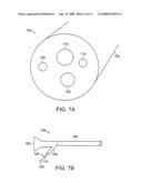 Gastrointestinal implant with drawstring diagram and image