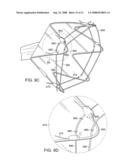 Gastrointestinal implant with drawstring diagram and image