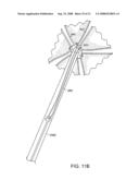 Gastrointestinal implant with drawstring diagram and image