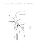 Peak Data Retention of Signal Data In An Implantable Medical Device diagram and image