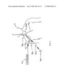 Peak Data Retention of Signal Data In An Implantable Medical Device diagram and image