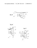 Pushpin retaining device and method of retaining without object puncture diagram and image