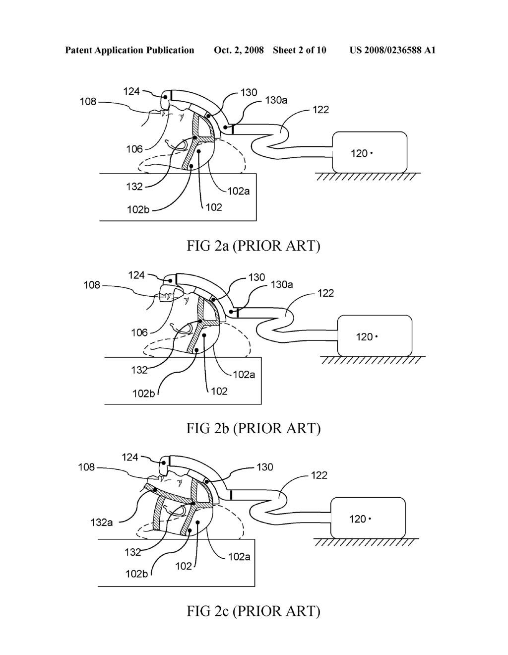 SUPPORT DEVICE FOR RESPIRATORY INTERFACE - diagram, schematic, and image 03