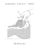 Laryngeal Mask Airway with a Belt, Operating Piece for Controlling the Same, and Gas Supply Kit Comprising the Same diagram and image