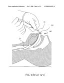 Laryngeal Mask Airway with a Belt, Operating Piece for Controlling the Same, and Gas Supply Kit Comprising the Same diagram and image