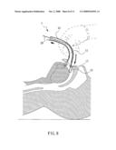 Laryngeal Mask Airway with a Belt, Operating Piece for Controlling the Same, and Gas Supply Kit Comprising the Same diagram and image