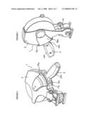 Nozzle diagram and image