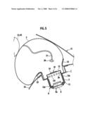 Airbag Device diagram and image