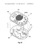 Discussion Unit with Removable Rim diagram and image