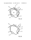 Low coefficient of thermal expansion materials including modified aluminosilicate fibers and methods of manufacture diagram and image