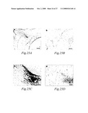 Transmembrane protein amigo and uses thereof diagram and image