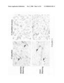 Composition and methods of RNAi therapeutics for treatment of cancer and other neovascularization diseases diagram and image