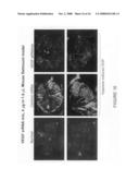 Composition and methods of RNAi therapeutics for treatment of cancer and other neovascularization diseases diagram and image