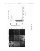 Composition and methods of RNAi therapeutics for treatment of cancer and other neovascularization diseases diagram and image