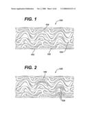 LOCAL VASCULAR DELIVERY OF PROBUCOL ALONE OR IN COMBINATION WITH SIROLIMUS TO TREAT RESTENOSIS, VULNERABLE PLAQUE, AAA AND STROKE diagram and image