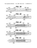 LOCAL VASCULAR DELIVERY OF PROBUCOL ALONE OR IN COMBINATION WITH SIROLIMUS TO TREAT RESTENOSIS, VULNERABLE PLAQUE, AAA AND STROKE diagram and image