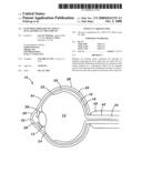 EXTENDED THERAPEUTIC EFFECT OCULAR IMPLANT TREATMENTS diagram and image