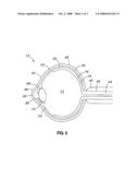 EXTENDED THERAPEUTIC EFFECT OCULAR IMPLANT TREATMENTS diagram and image