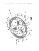 Gas Burner diagram and image