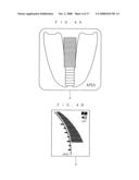 Root canal length measuring apparatus and root canal therapy apparatus diagram and image