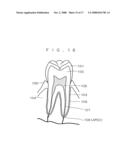 Root canal length measuring apparatus and root canal therapy apparatus diagram and image