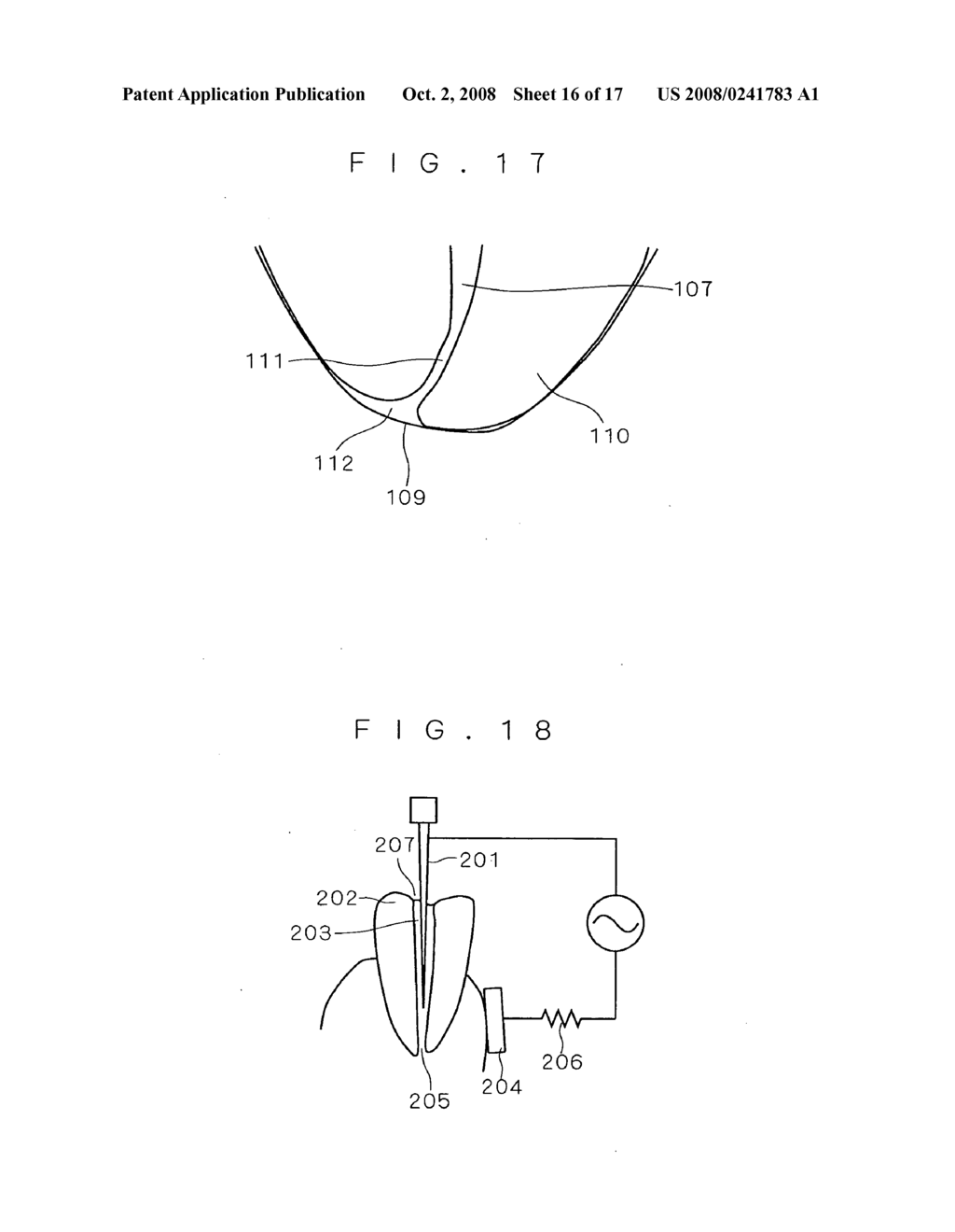 Root canal length measuring apparatus and root canal therapy apparatus - diagram, schematic, and image 17