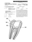 KITS AND METHODS FOR CHAIR-SIDE COATING OF ENDODONTIC CONES diagram and image