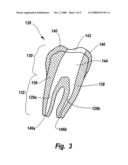 KITS AND METHODS FOR CHAIR-SIDE COATING OF ENDODONTIC CONES diagram and image