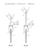 KITS AND METHODS FOR CHAIR-SIDE COATING OF ENDODONTIC CONES diagram and image