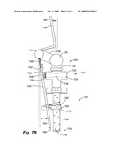 METHOD AND SYSTEM FOR WASHING INTESTINES diagram and image