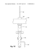 METHOD AND SYSTEM FOR WASHING INTESTINES diagram and image