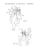 Method and Device for Processing a Slaughter Animal diagram and image