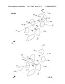 Apparatus and method for determining an optimized path traversal for radiation treatment delivery system diagram and image