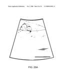 Electrostatically driven image probe diagram and image