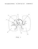 Pulmonary Artery Pressure Signals And Methods of Using diagram and image