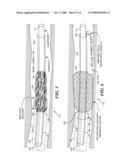 MULTIFUNCTION CANNULA TOOLS diagram and image