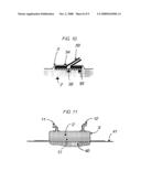 Device For Active Treatment and Regeneration of Tissues Such as Wounds diagram and image