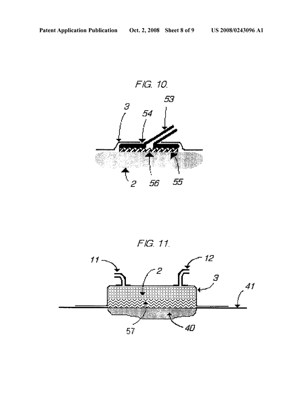 Device For Active Treatment and Regeneration of Tissues Such as Wounds - diagram, schematic, and image 09