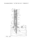 Surgical instrument having a fastener delivery mechanism diagram and image