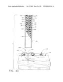 Surgical instrument having a fastener delivery mechanism diagram and image