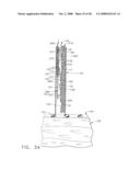 Surgical instrument having a fastener delivery mechanism diagram and image