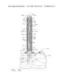 Surgical instrument having a fastener delivery mechanism diagram and image