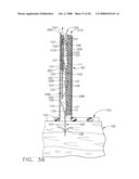 Surgical instrument having a fastener delivery mechanism diagram and image