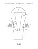 LOCATING AND OCCLUDING VESSELS diagram and image