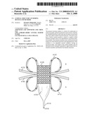 Luminal Structure Anchoring Devices and Methods diagram and image