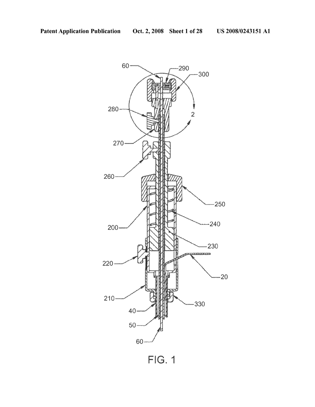 Luminal Structure Anchoring Devices and Methods - diagram, schematic, and image 02